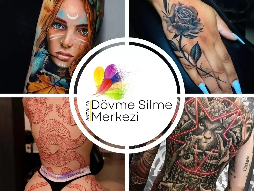 Lazerle Dövme Silme: Kalıcı mı Yoksa İz Bırakır mı?