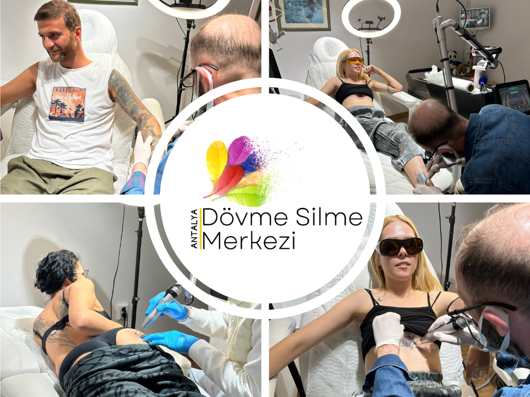 Lazerle Dövme Silme Acıtır Mı? İşlem Esnasında Neler Hissedersiniz?